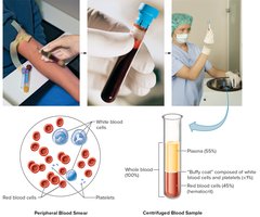 Centrifuged blood sample and peripheral blood smear