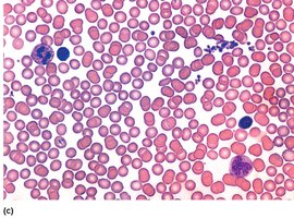 Agglutinated red blood cells