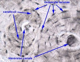 Microscopic view of compact bone showing osteons, Haversian canals, canaliculi, and lacunae