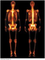 Radiotracer imaging of skeleton