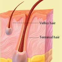 Diagram showing vellus and terminal hair