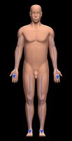 Comparison of proximal and distal