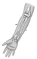Standard anatomical position, anterior view