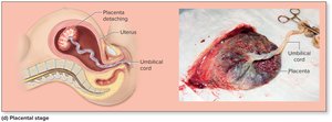 Stages of true labor and childbirth: placental stage