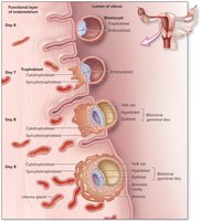 Implantation of the blastocyst