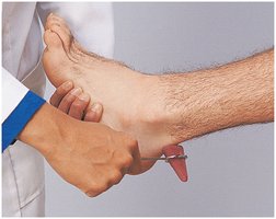 Babinski sign (plantar reflex)
