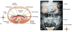 Cross-sectional and radiographic views of the kidneys and urinary system