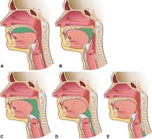 Anatomy of the larynx, including cartilages and vocal cords
