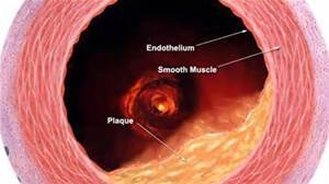 Blood Vessel Lumen with Endothelium
