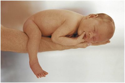 C-shaped spine of a newborn infant