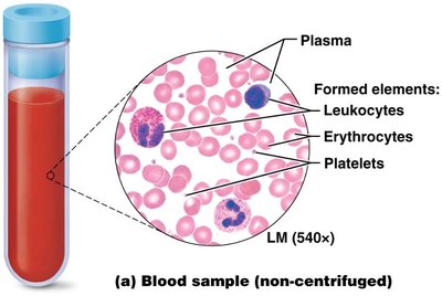 Blood sample showing plasma, leukocytes, erythrocytes, and platelets