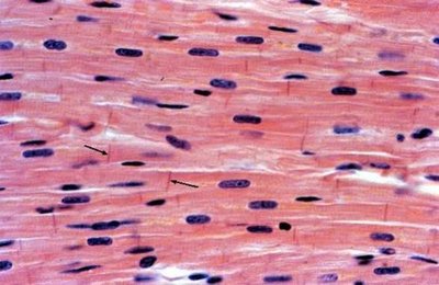 Skeletal muscle H&E stain showing striations