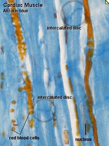 Cardiac muscle histology with intercalated discs