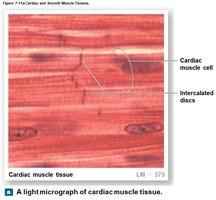 Cardiac muscle tissue