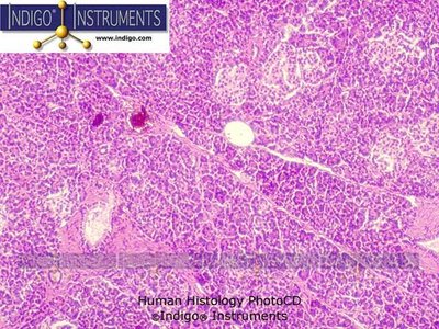 Histological slide of pancreas showing islets and acinar cells