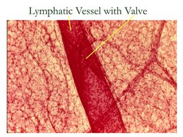 Lymphatic vessel with valve