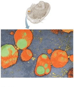 Electron micrograph of lysosomes