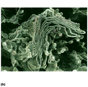 Electron micrograph of the Golgi apparatus