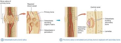 Process of fracture repair