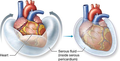 Serous fluid in pericardium