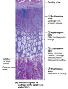 Photomicrograph of cartilage in the epiphyseal plate