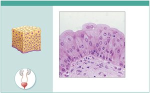 Photomicrograph of transitional epithelium in bladder