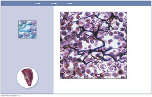 Photomicrograph of reticular connective tissue in spleen