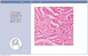 Photomicrograph of dense irregular connective tissue in dermis
