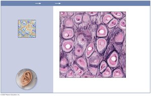 Photomicrograph of elastic cartilage in ear
