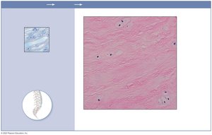 Photomicrograph of fibrocartilage in intervertebral disc