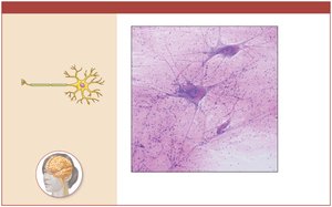 Photomicrograph of nervous tissue showing neurons and neuroglia