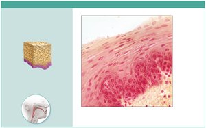 Photomicrograph of stratified squamous epithelium in esophagus