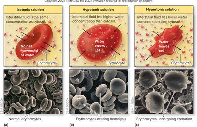 Hypotonic solution: cell swells