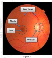 Labeled retina showing macula, fovea, blood vessels, and optic disc