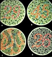 Examples of Ishihara color plates for color blindness testing