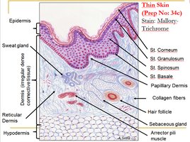 Histology of thin skin showing epidermis, dermis, and hypodermis