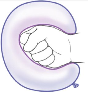 Serous fluid between membrane layers