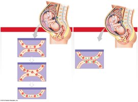 Hemolytic disease of the newborn