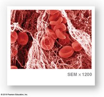 Scanning electron micrograph of blood clot