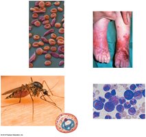 Blood disorders