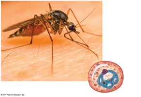 Malaria