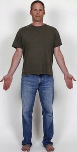 Standard anatomical position