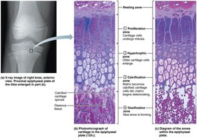 Epiphyseal plate and zones of growth