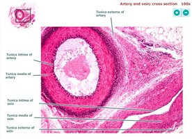 Artery and vein cross section, high magnification