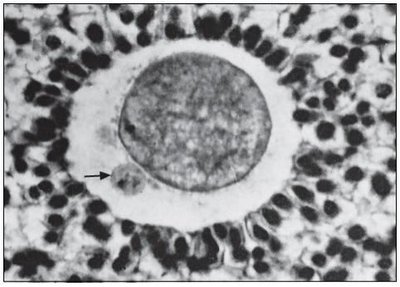 Microscopic image of a primordial follicle with primary oocyte