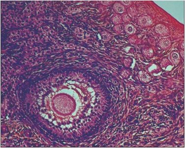 Histological section of a developing ovarian follicle