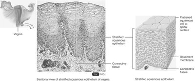 Sectional view of stratified squamous epithelium in the vagina