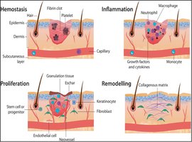 Steps of tissue repair: hemostasis, inflammation, proliferation, remodeling