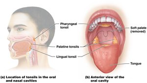 Location of the tonsils