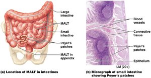 MALT of the intestines and Peyer's patches